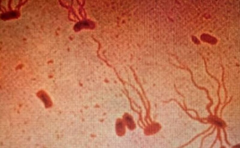 Typhoid Fever Is Becoming Resistant To Antibiotics: Lancet Study